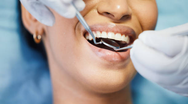 Best Urgent Tooth Repair  in Richland, GA