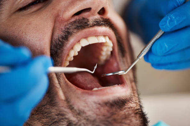Best Knocked-Out Tooth Emergency  in Richland, GA