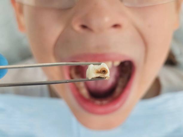 Best Teeth Whitening  in Richland, GA